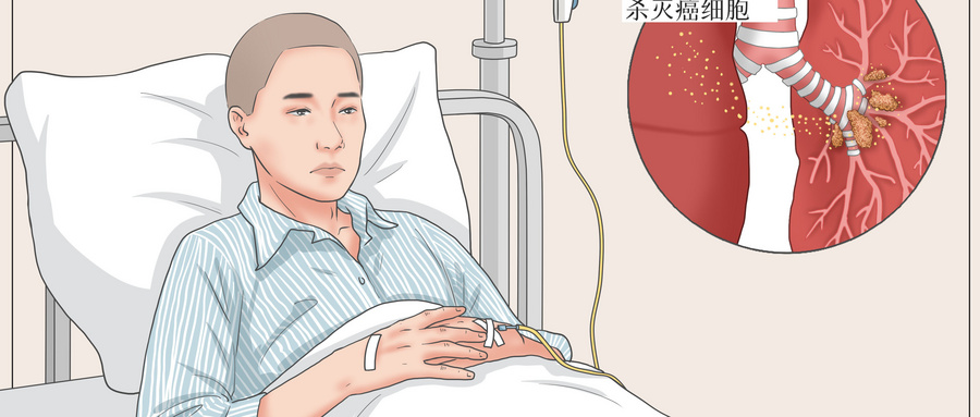 摄图网_401803185_wx_肺癌化学治疗医疗插画（企业商用）.jpg